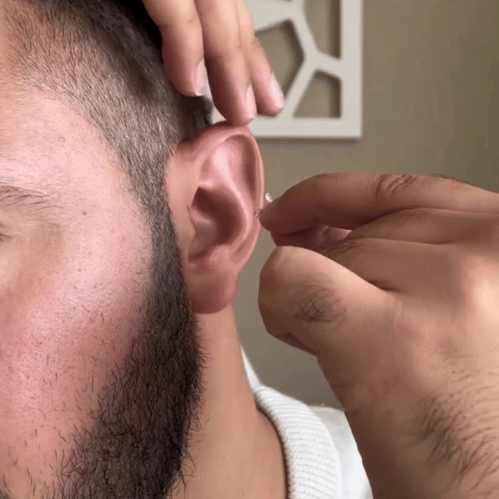 Clévia™ Invisible Ear Correctors