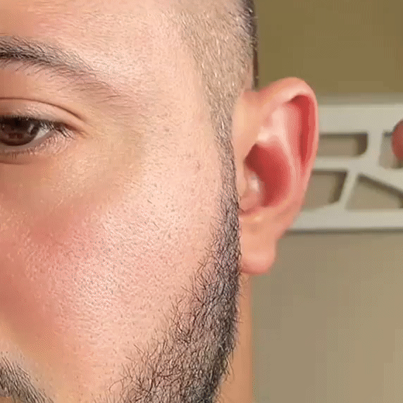 Clévia™ Invisible Ear Correctors